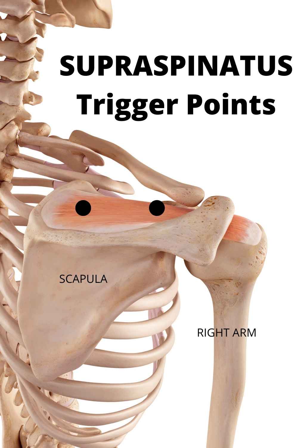 frozen shoulder trigger points